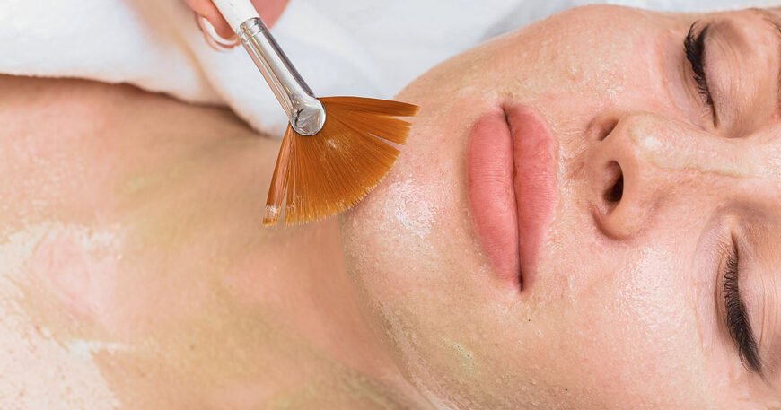Choosing the Right Chemical Peel for Your Skin Type