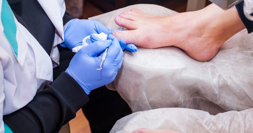 How To Prevent and Treat Ingrown Toenails