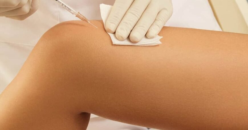 Choosing Between Sclerotherapy and Other Vein Treatments