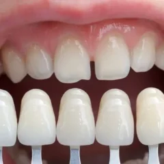 FAQs About Pediatric Dentistry