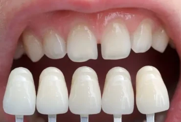 FAQs About Pediatric Dentistry