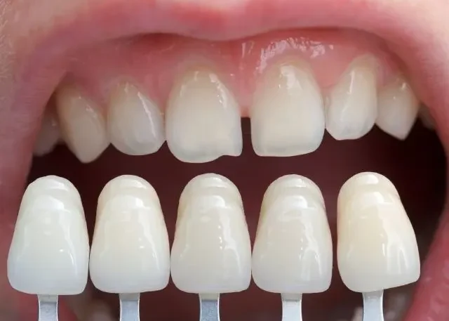 FAQs About Pediatric Dentistry
