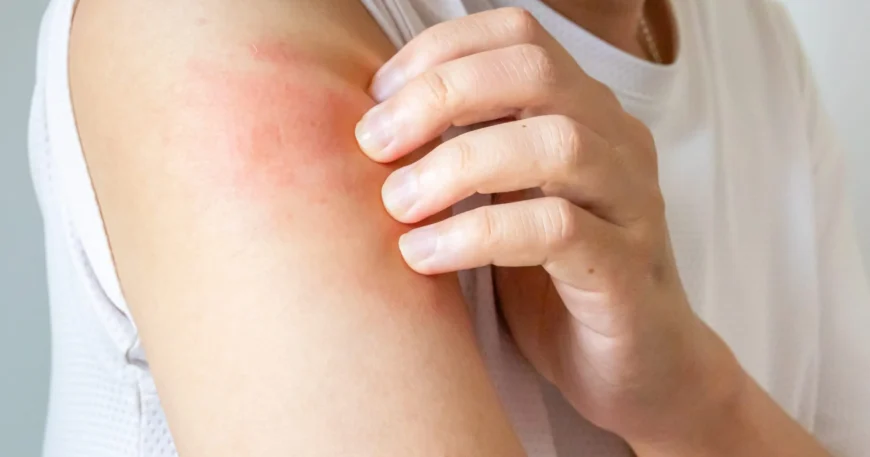 How To Choose the Right Dermatologist for Your Skin Concerns