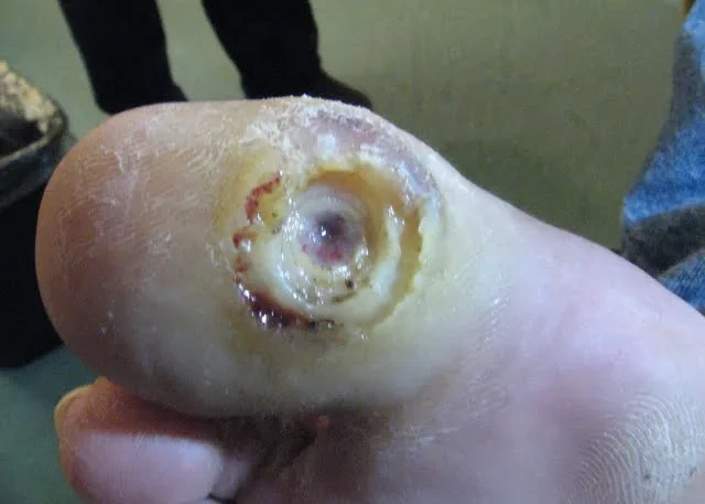 Innovative Wound Care Products You Should Know About