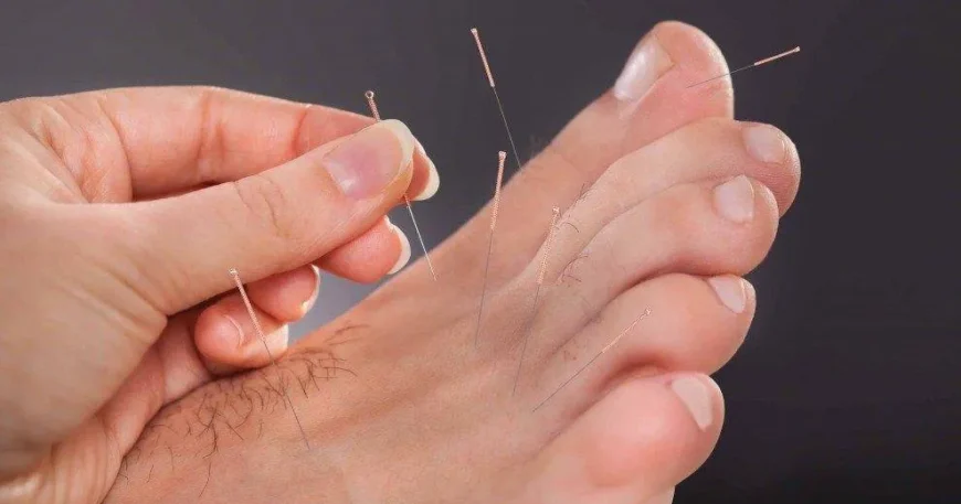 Remedies for Relieving Plantar Fasciitis Pain
