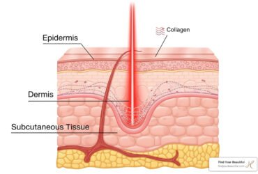 Understanding the Stages of Wound Healing