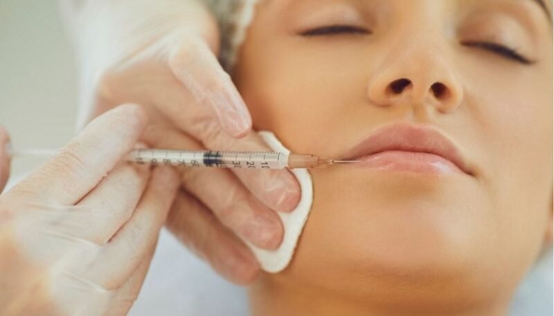 What Areas Do Dermal Fillers Help Improve?