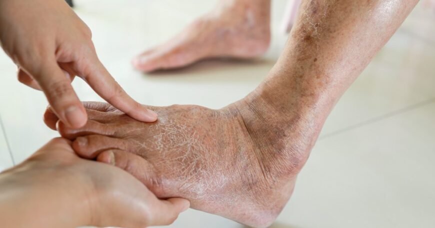 What to Know About Podiatry for Diabetic Patients
