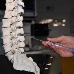 When Are Epidural Injections Recommended?