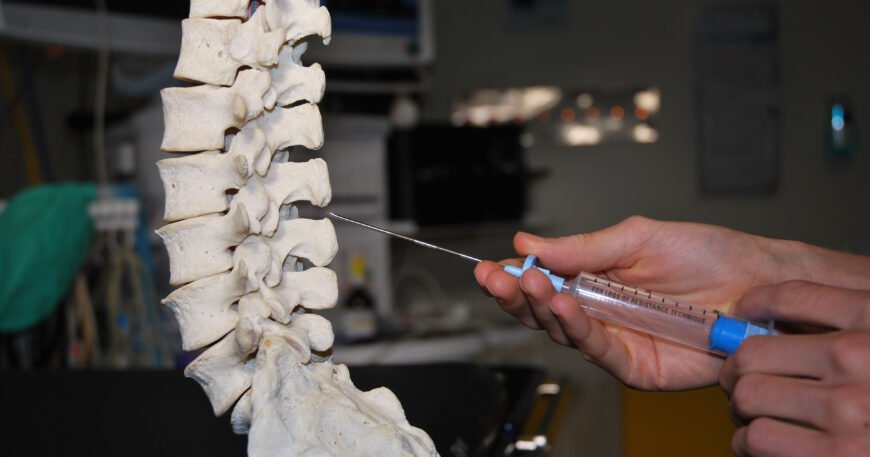 When Are Epidural Injections Recommended?