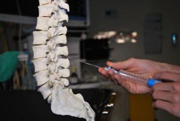 When Are Epidural Injections Recommended?