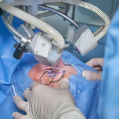 Exploring the Benefits of LASIK Surgery for Vision Correction