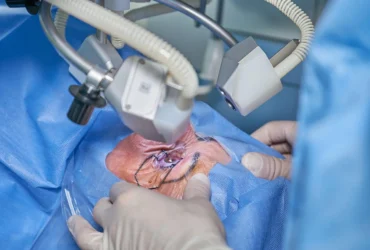 Exploring the Benefits of LASIK Surgery for Vision Correction Exploring the Benefits of LASIK Surgery for Vision Correction