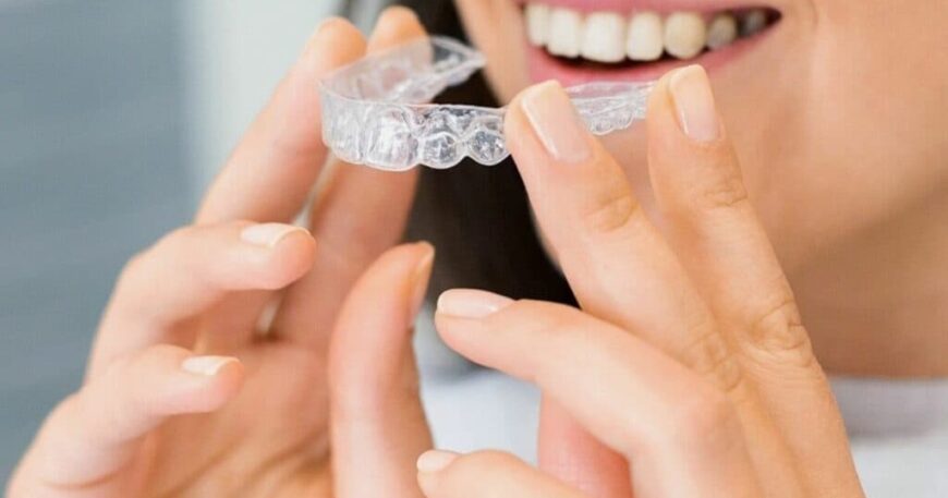 How Aligner Material Affects Treatment Performanc