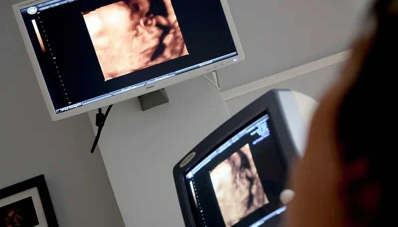 How Ultrasounds Help Monitor Fetal Development