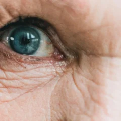 Lifestyle Changes To Alleviate Dry Eye Symptoms