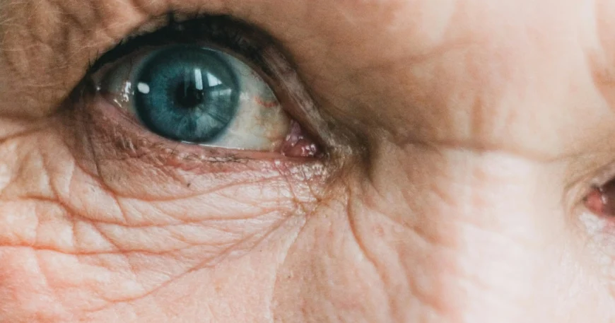 Lifestyle Changes To Alleviate Dry Eye Symptoms