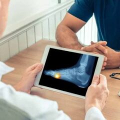 What Can a Podiatry Expert Help With?