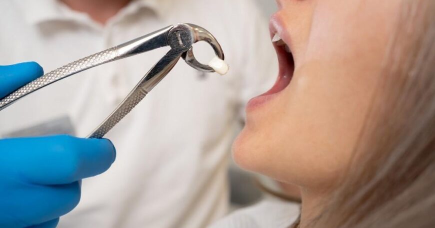 Exploring Procedures Performed by Endodontists