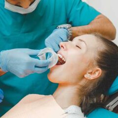 How To Find an Experienced Dentist in Your Area