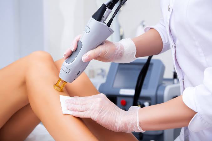 The Long-Term Benefits of Laser Hair Removal